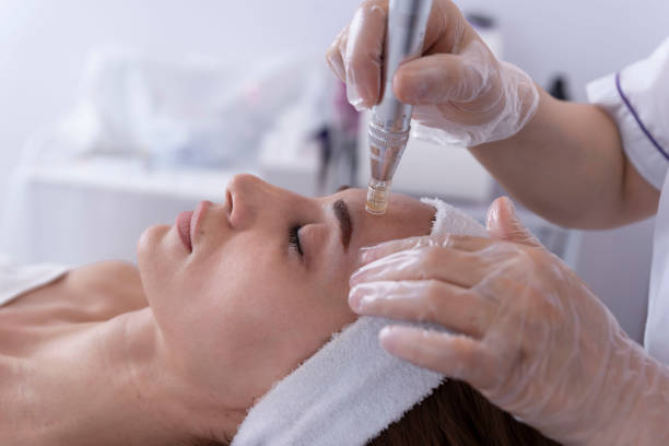 Microneedling vs Dermarolling: Which Is Right for You?