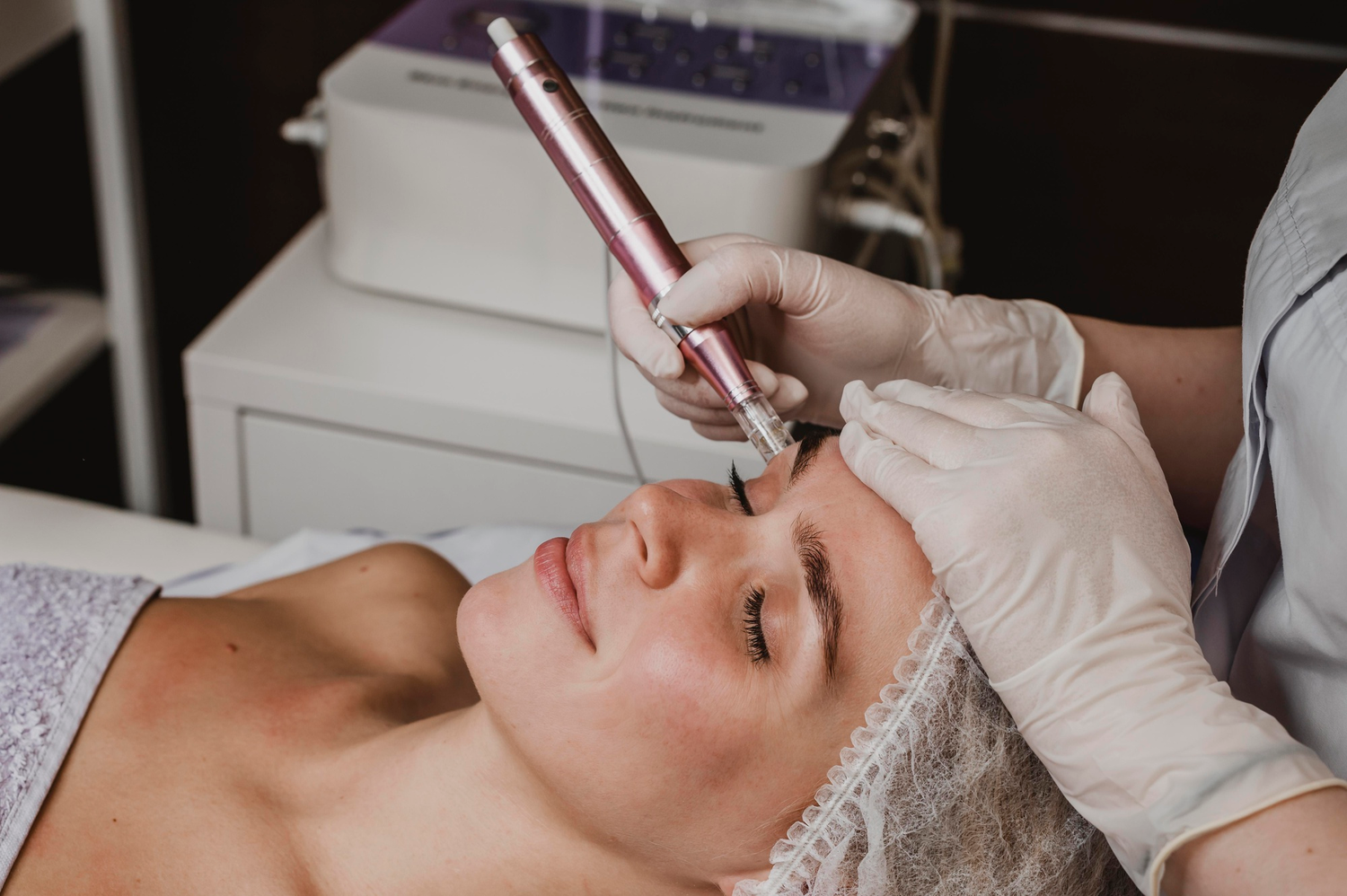 Microneedling Queens