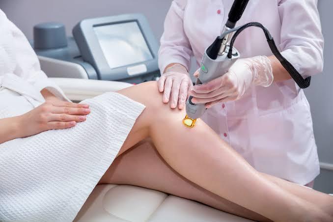 Candela Laser Hair Removal Technology