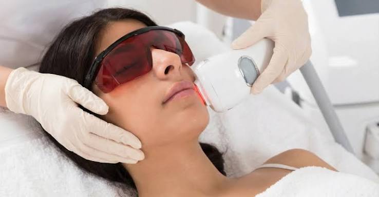 Laser Hair Removal Treatments